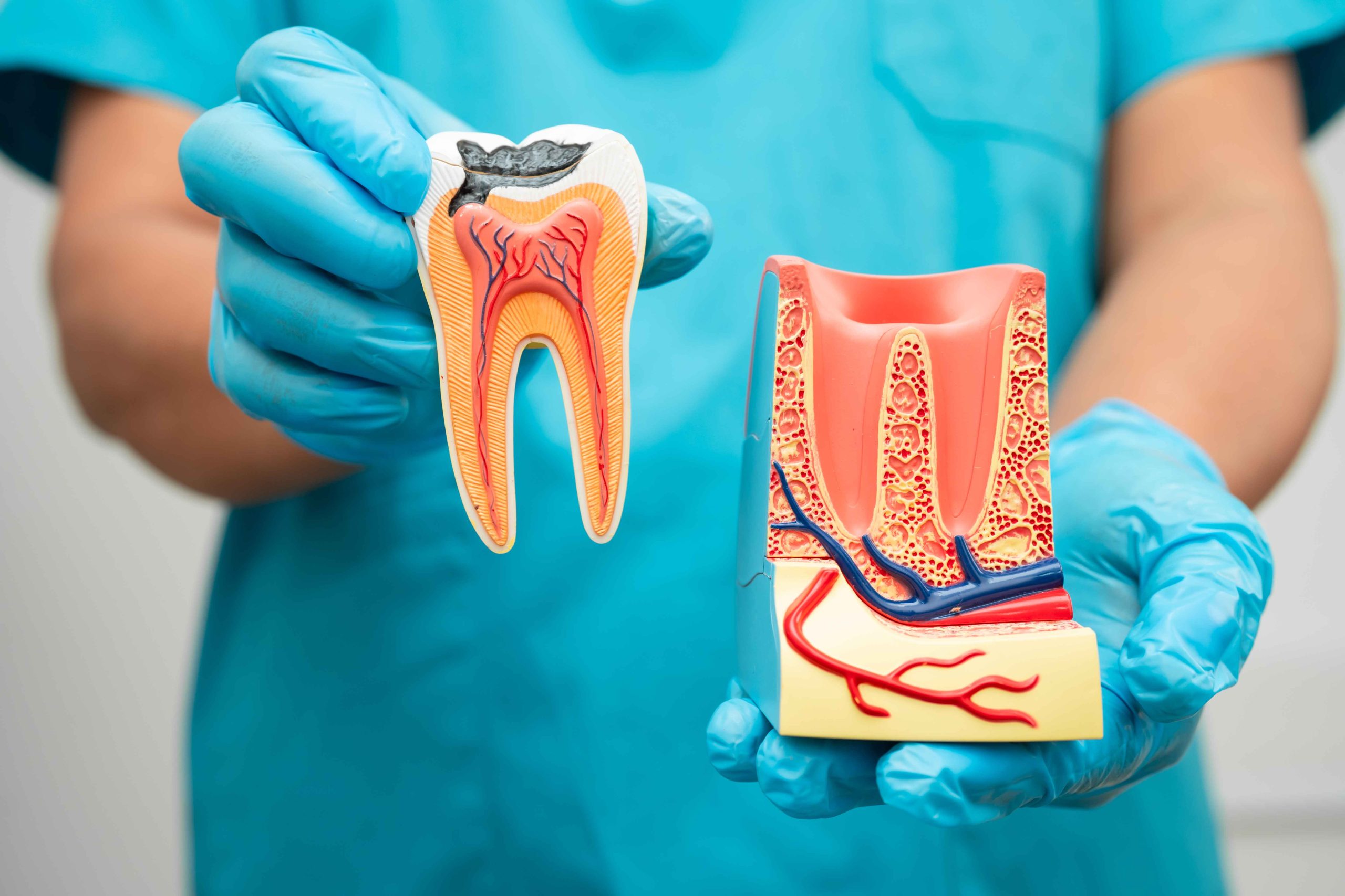 What Affects Molar Root Canal Price Dubai In Clinics?