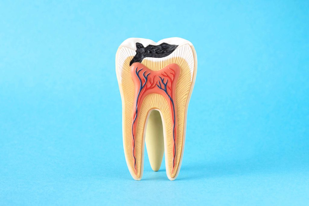 What Affects Molar Root Canal Price Dubai In Clinics?